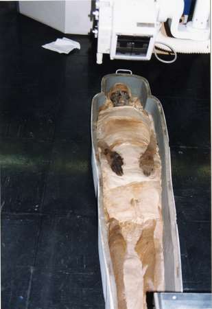 Radiographie momie © archives Musée de Picardie